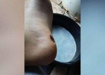 Sete veranistas foram atacados por piranhas na prainha de Itaipulândia