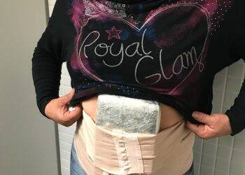 Mulher é presa no Aeroporto de Foz com drogas presas ao corpo