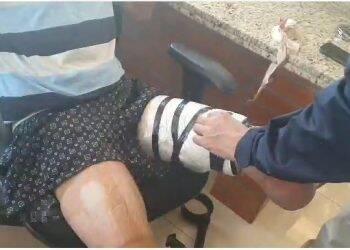 Homem é flagrado transportando droga superpotente em perna amputada