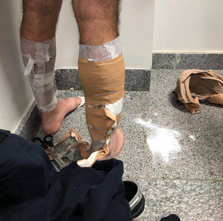 Argentino é preso no aeroporto de Foz do Iguaçu com 1,8kg de cocaína preso ao corpo.
