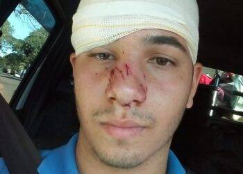 Leiturista da SANEPAR sofre ataque grave de cão em Foz