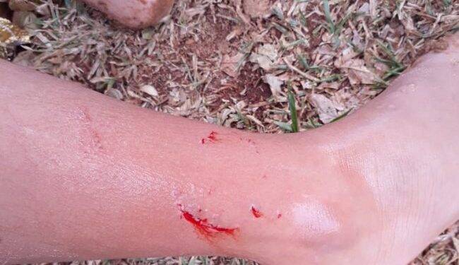 Criança pode ter sido atacada por sucuri na praia de Santa Helena