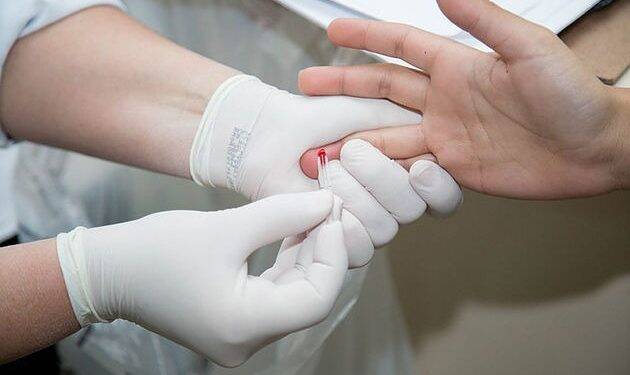 Saúde e Rotary fazem mutirão de testes de sífilis, hepatite e HIV