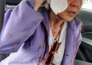 Professores ficam feridos após confronto com a polícia na ALEP em Curitiba