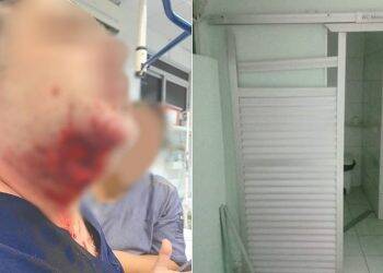 Paciente surta e arranca pedaço do pescoço de médico com mordida