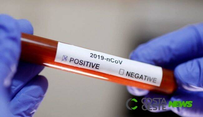 Guaíra confirma primeiro caso de coronavírus