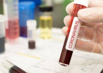 Coronavírus: pandemia vai superlotar hospitais brasileiros e governo deve restringir eventos em breve, diz infectologista