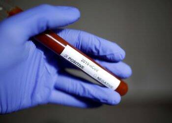 Planos de saúde recomendam procurar emergência apenas em casos graves