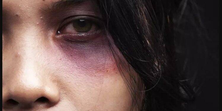 Violência contra a mulher em Foz sobe no último ano