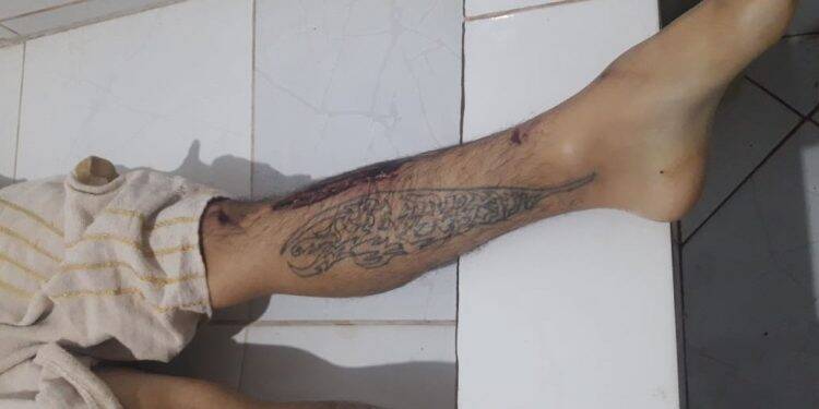 Paraguai pede ajuda para identificar corpo possivelmente de brasileiro