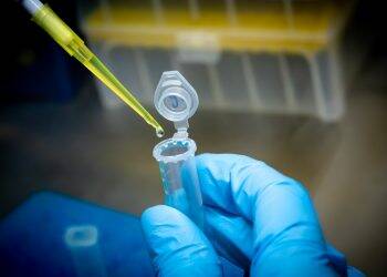 Hospital Costa Cavalcanti poderá fazer em breve testes rápidos da covid-19