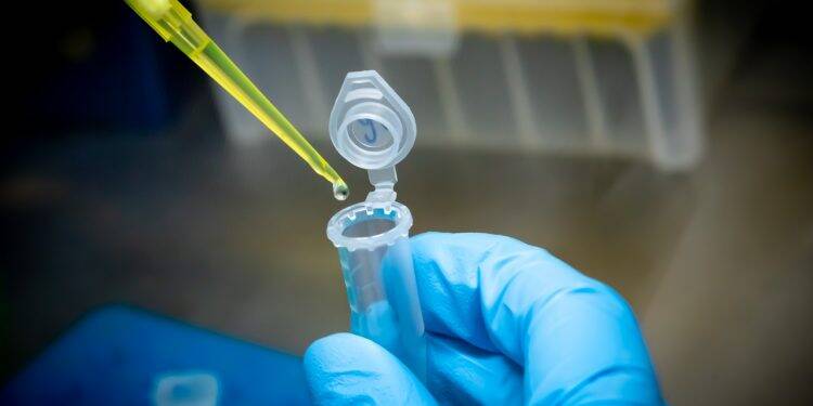 Hospital Costa Cavalcanti poderá fazer em breve testes rápidos da covid-19