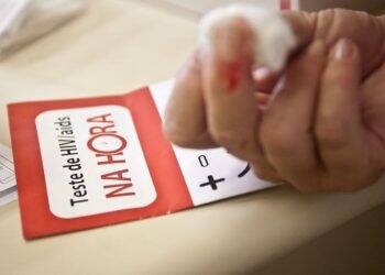 Homem do Reino Unido é o segundo curado de HIV no mundo