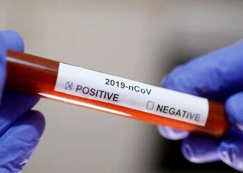 Jovem sem sintomas é quarto caso de infecção por Covid-19 no país