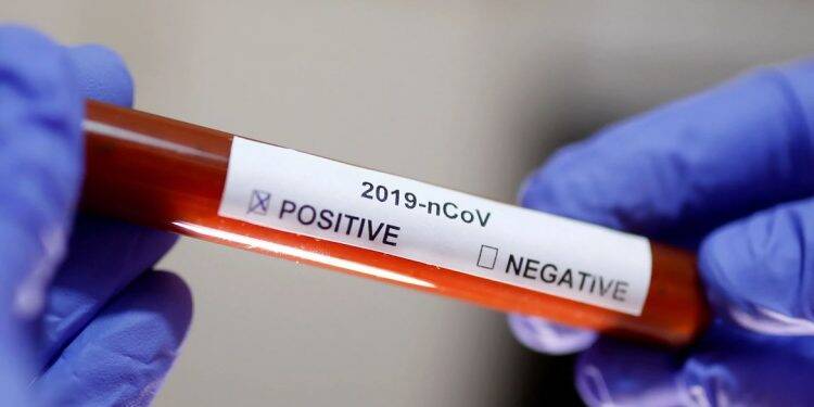 Jovem sem sintomas é quarto caso de infecção por Covid-19 no país