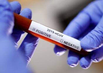 Prefeitura adquire 20 mil testes para a COVID-19