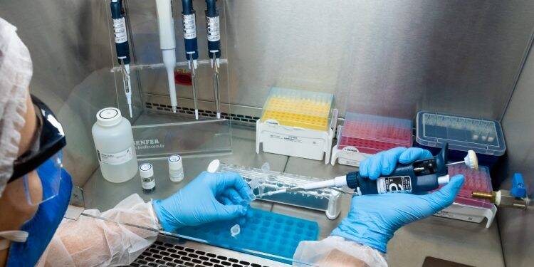 Hospital Costa Cavalcanti é habilitado pelo Lacen para fazer teste de covid-19