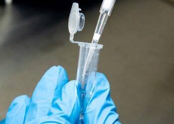 Hospital Costa Cavalcanti é habilitado pelo Lacen para fazer teste de covid-19