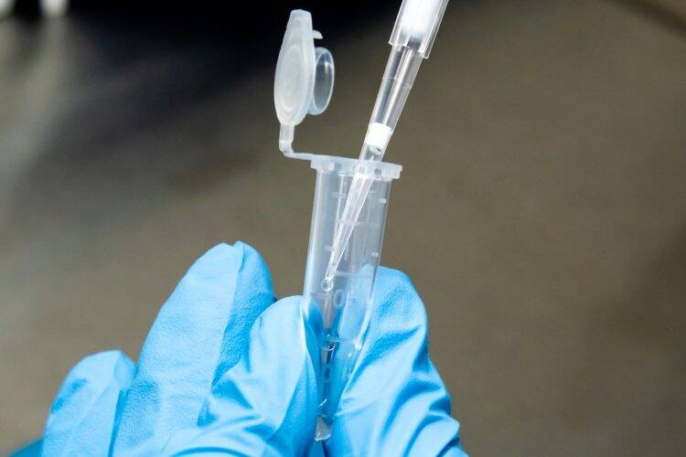 Hospital Costa Cavalcanti é habilitado pelo Lacen para fazer teste de covid-19