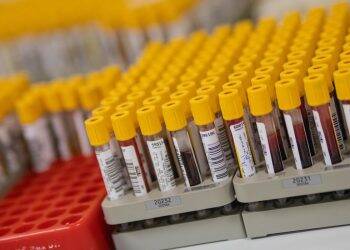 Brasil registra 1.124 óbitos pela covid-19; são mais de 20,7 mil casos
