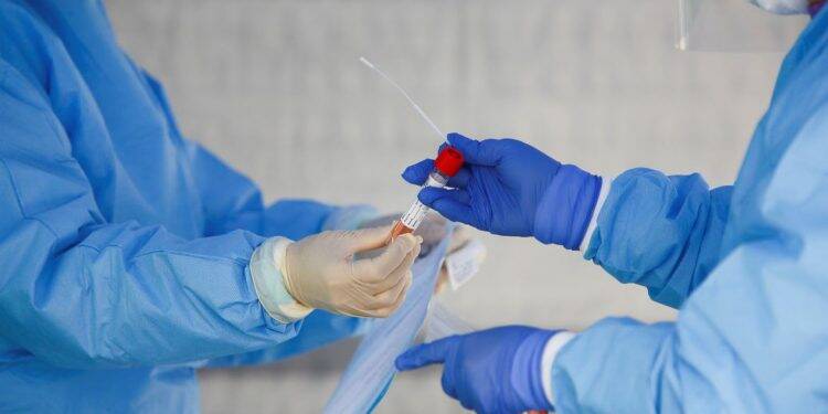 Laboratórios agropecuários poderão atuar no diagnóstico de covid-19