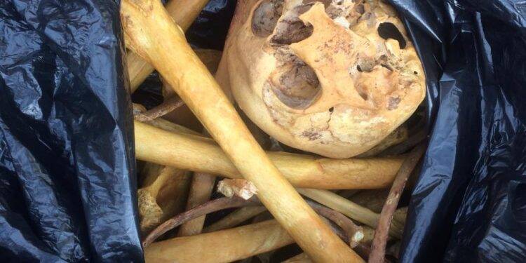 Coletor de lixo encontra ossada humana no Bairro Morumbi