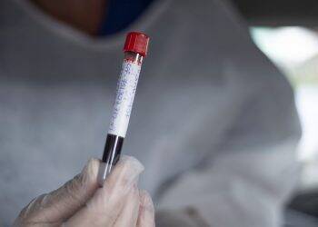 Colaboradores do Hospital Municipal fazem testes para Covid-19