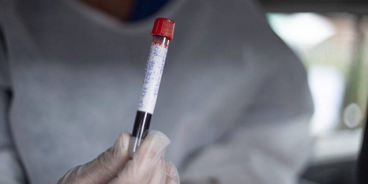 Colaboradores do Hospital Municipal fazem testes para Covid-19