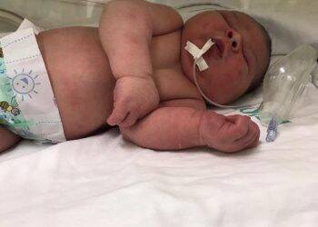 Inusitado: Bebê nasce com aproximadamente 5,2 quilos em Cascavel