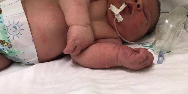 Inusitado: Bebê nasce com aproximadamente 5,2 quilos em Cascavel