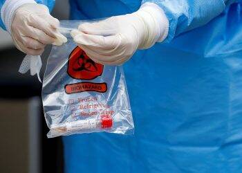 Tipo sanguíneo e genes estão ligados à covid-19 grave, mostra estudo