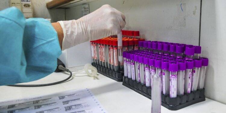 Hospital investiga se pacientes foram reinfectados pelo coronavírus