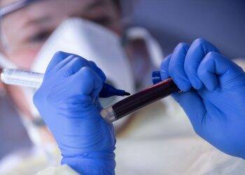 Covid-19: casos semanais crescem e mortes oscilam, avalia ministério