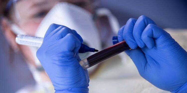 Covid-19: casos semanais crescem e mortes oscilam, avalia ministério