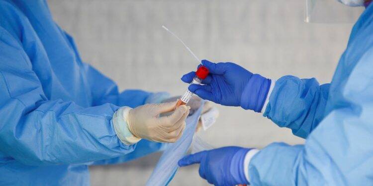 Saiba como funcionam os testes para detectar a covid-19