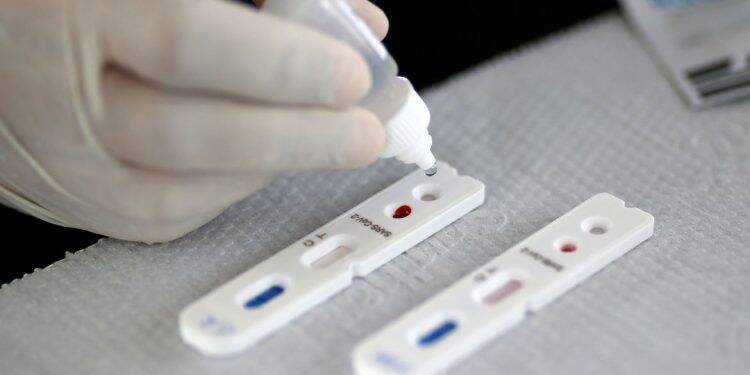 Covid-19: Brasil tem 3 milhões de recuperados e 120 mil mortes