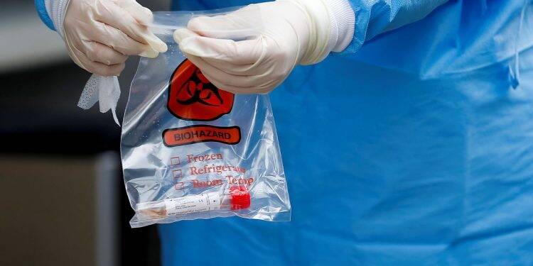 Laboratório Central do Paraguai tem testes de Covid-19 para mais 10 dias