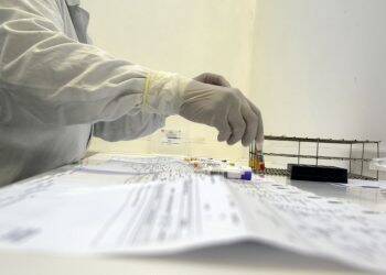 Estado alerta para doença rara que pode estar associada à Covid-19