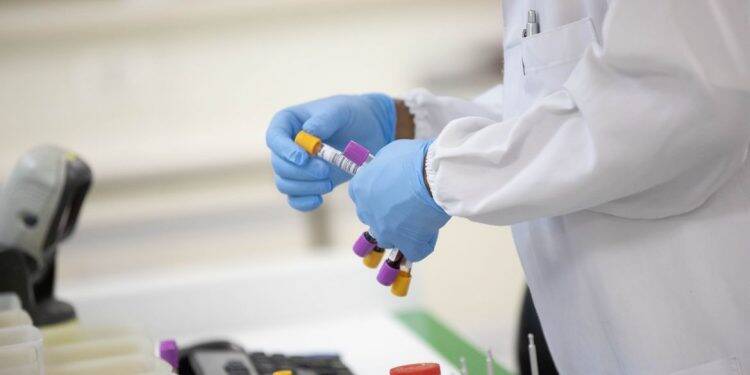 Covid-19: em uma semana, casos caem 30% e mortes, 13% no Brasil