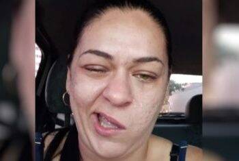 Vídeo enviado para patroa após ida ao dentista viraliza por boca torta de paciente; veja