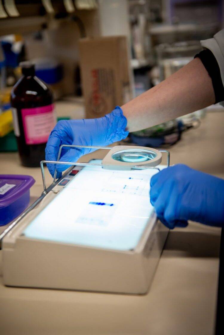 Vacina desenvolvida no Paraná induz produção maior de anticorpos que a de Oxford em fase pré-clínica