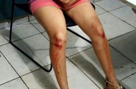 MS: Mulher é espancada por cinco pessoas ao ser apontada como ‘bruxa’