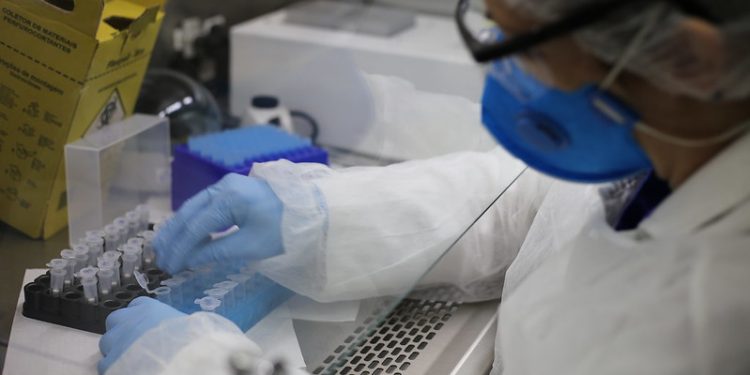 Parceria entre Prefeitura de Foz e Lacen garante testes para detecção da Covid-19