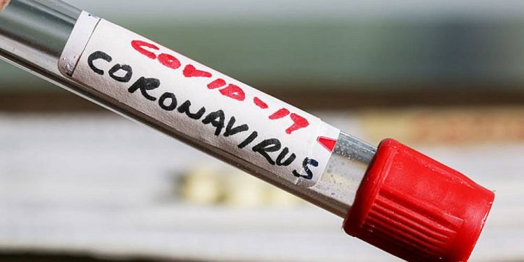 Variante brasileira do novo coronavírus já circula em quase todo o Paraguai