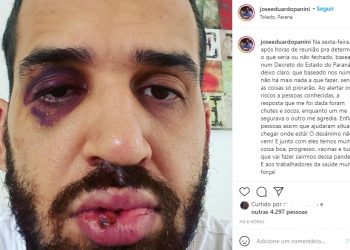 Médico infectologista é agredido após defender lockdown em Toledo: “Um me segurava e outro me agredia”