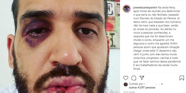 Médico infectologista é agredido após defender lockdown em Toledo: “Um me segurava e outro me agredia”