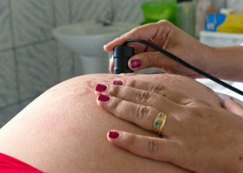 Óbitos de grávidas em 2021 já ultrapassam total de 2020