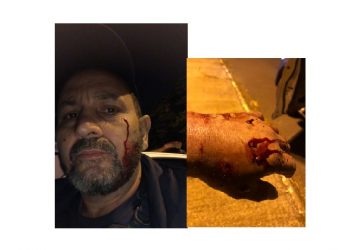 Guarda municipal é agredido por usuário de crack