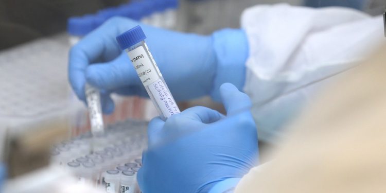 Paraná já registrou 55 mortes pela gripe H3N2