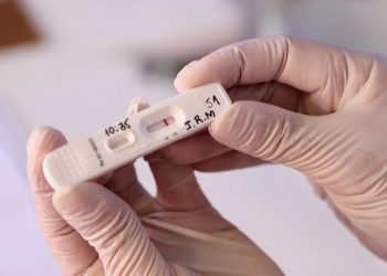 Cinco unidades de saúde serão referência para testes de Covid em pessoas assintomáticas